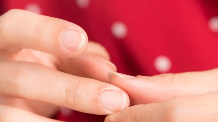 5 Signs of Iron Deficiency on Skin, Hair and Nails